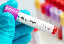 Norovirus Alert: ठंड में तेजी से फैल रहा संक्रमण, जानें लक्षण और बचाव उपाय